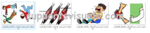 حوادث العضلات